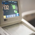 shallow focus of electrocardiogram